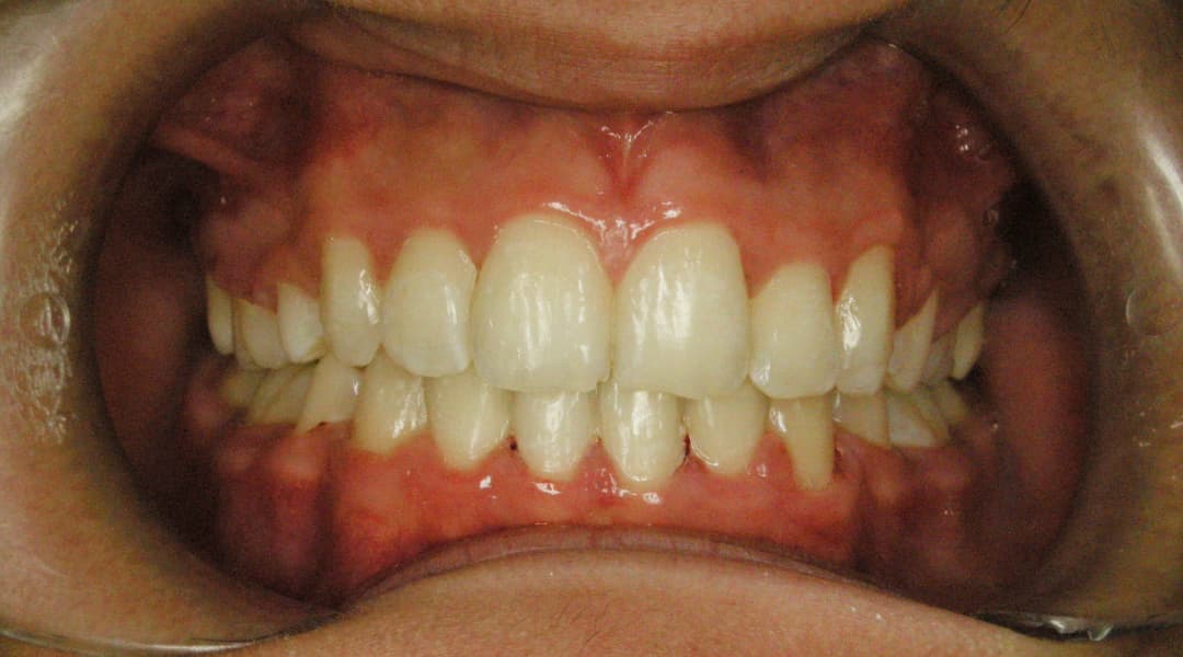 Premena Ortodoncia ffe2353b-27b8-4353-97f4-680540274e45 — po