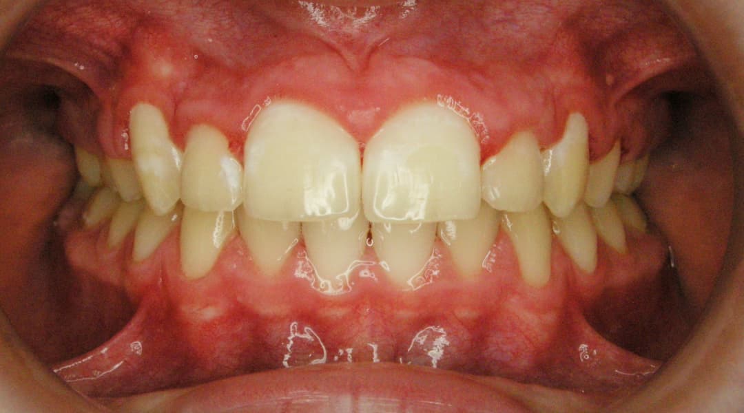 Premena Ortodoncia bbd55ba5-b37e-436a-ad81-ca4a16520585 — po