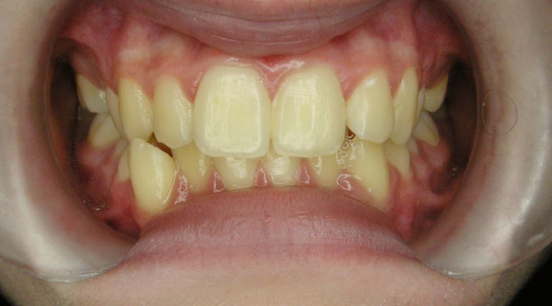Premena Ortodoncia 5e9fd298-6f42-4e0c-a1a8-292c5abc59a2 — po