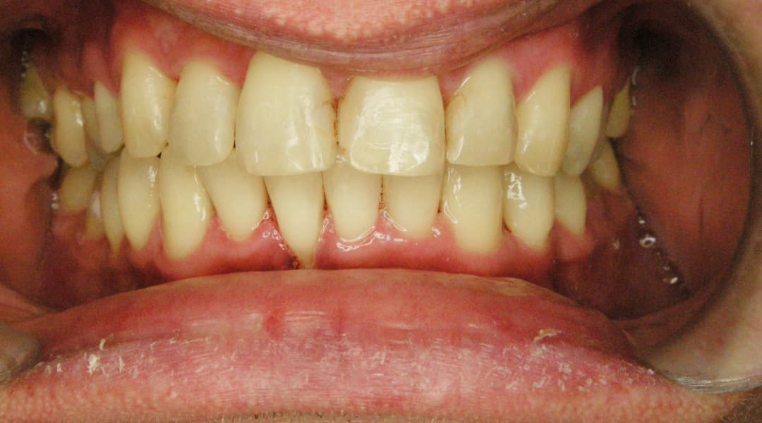 Premena Ortodoncia 0893ad88-7a1b-4c77-ad01-a1de4645bad8 — po