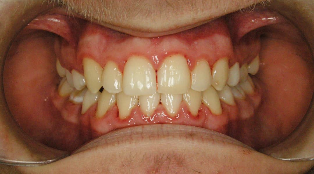 Premena Ortodoncia 0b735654-9c54-4e3b-a59e-738baf6b67f2 — po