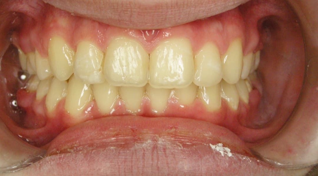 Premena Ortodoncia 47b2449f-9c7a-4cad-99ed-370499e50e26 — po